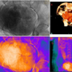 Radiografías y tomografías computarizadas del abdomen de la momia que revelan al feto